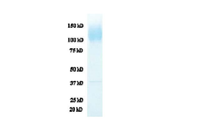 Purified HIV-2 gp120 protein (NIH-Z)